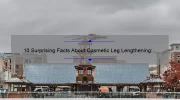 10 Surprising Facts About Cosmetic Leg Lengthening: A Personal Story and Practical Guide [Keyword]