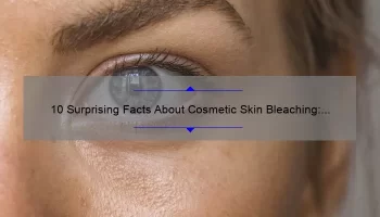 10 Surprising Facts About Cosmetic Skin Bleaching: A Personal Story and Expert Tips [Ultimate Guide]