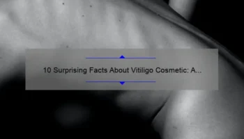 10 Surprising Facts About Vitiligo Cosmetic: A Personal Journey to Clearer Skin [Expert Tips and Solutions]