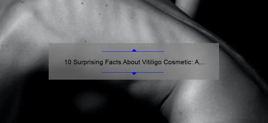 10 Surprising Facts About Vitiligo Cosmetic: A Personal Journey to Clearer Skin [Expert Tips and Solutions]