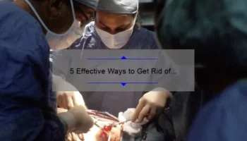 5 Effective Ways to Get Rid of Acne Scars: Discover the Best Cosmetic Treatment [2021 Guide]