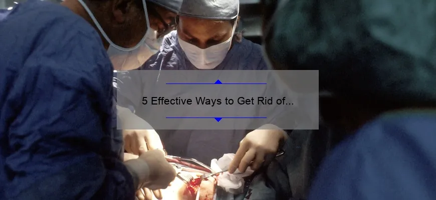 5 Effective Ways to Get Rid of Acne Scars: Discover the Best Cosmetic Treatment [2021 Guide]