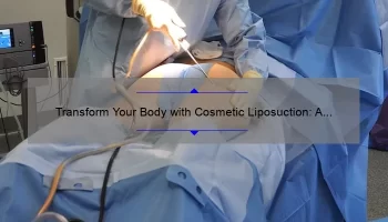 Transform Your Body with Cosmetic Liposuction: A Personal Story and Expert Guide [2021 Statistics and Tips]