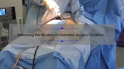 Unlocking the Mystery of Cosmetic Surgery Covered by Insurance: A Personal Story and Practical Guide [with Stats and Tips]