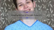 Unveiling the Cost of Cosmetic Surgery: A Personal Story and Practical Guide [with Stats and Tips]