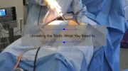 Unveiling the Truth: What You Need to Know About Insurance Coverage for Cosmetic Surgery [With Real-Life Stories and Data-Driven Insights]