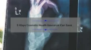 5 Ways Cosmetic Health Insurance Can Save You Money [Real-Life Story & Expert Tips]