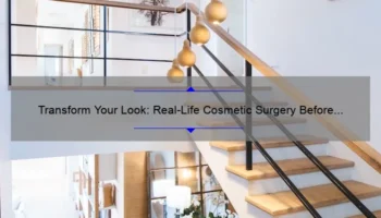 Transform Your Look: Real-Life Cosmetic Surgery Before and After Stories [Expert Tips and Stats]