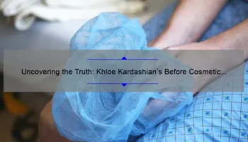 Uncovering the Truth: Khloe Kardashian’s Before Cosmetic Surgery Story [With Useful Information and Statistics]